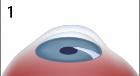 Le masque effectif pour la personne des taches de pigment